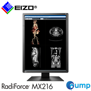 EIZO RadiForce MX216 Cost-Performance Medical Monitor