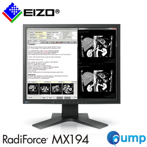 EIZO RadiForce MX194 Clinical Review 1 Megapixel Monitor